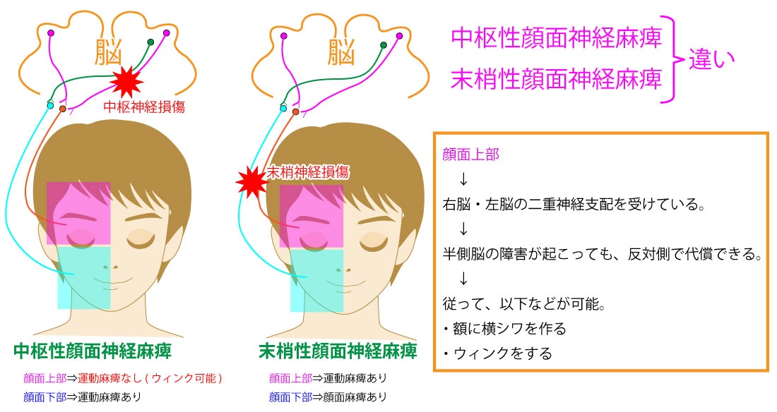 末梢血管疾患と末梢動脈疾患の症状