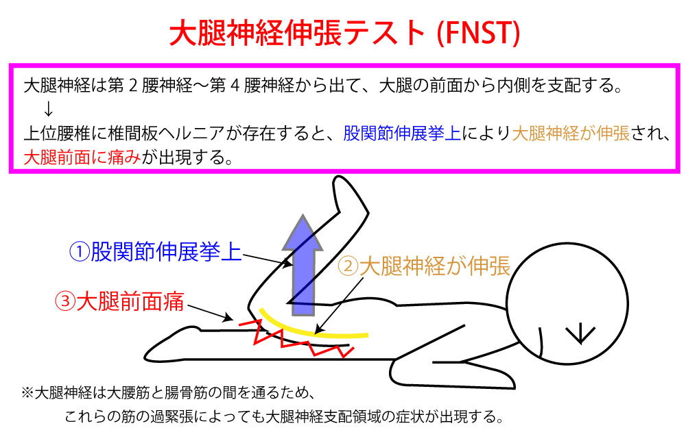 絞扼性ヘルニアの原因は何ですか?