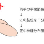 ファレンテスト【手根管症候群(正中神経絞扼)の検査】