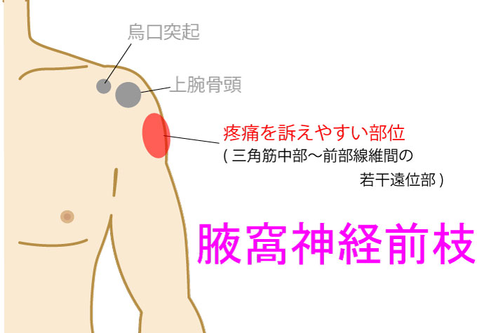腋窩神経機能障害はどのように診断されますか?