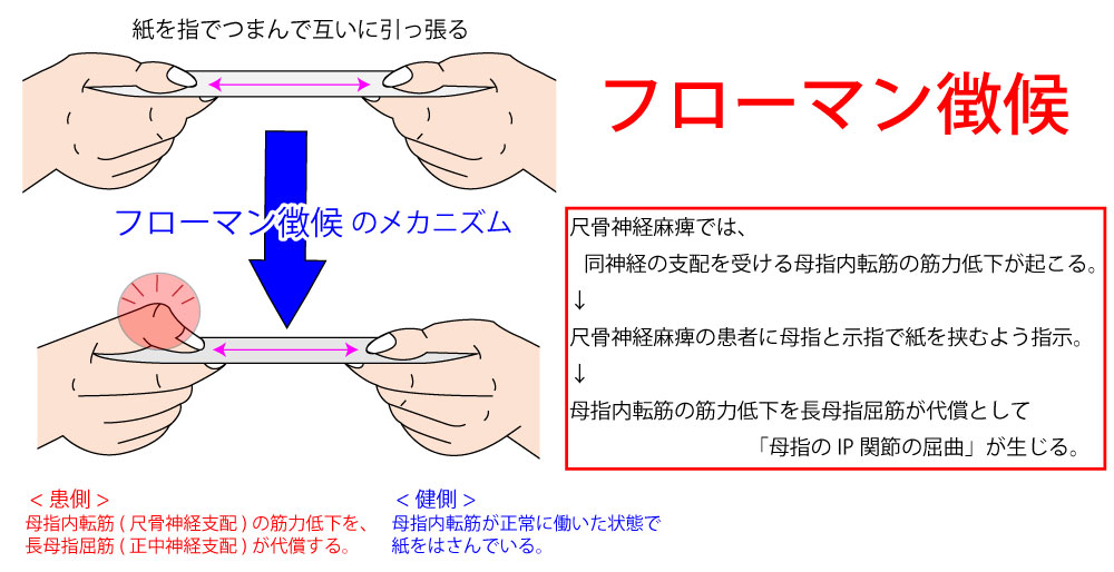 流産が起こった場合